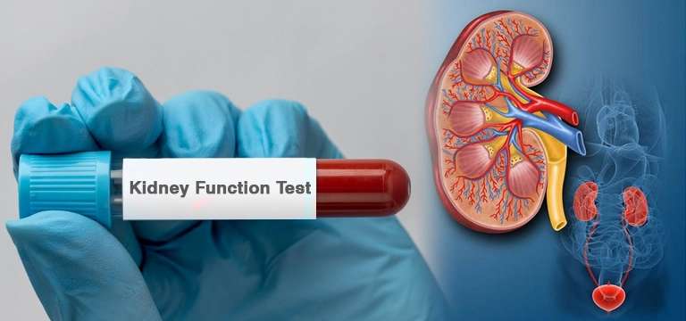 A Complete Guide to Kidney Function Test